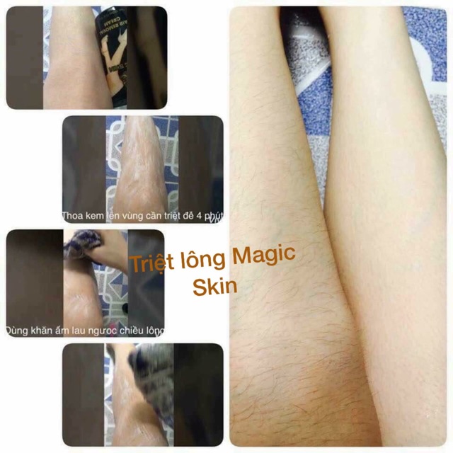 Kem triệt lông magicskin giảm 50% còn 160k giá shock