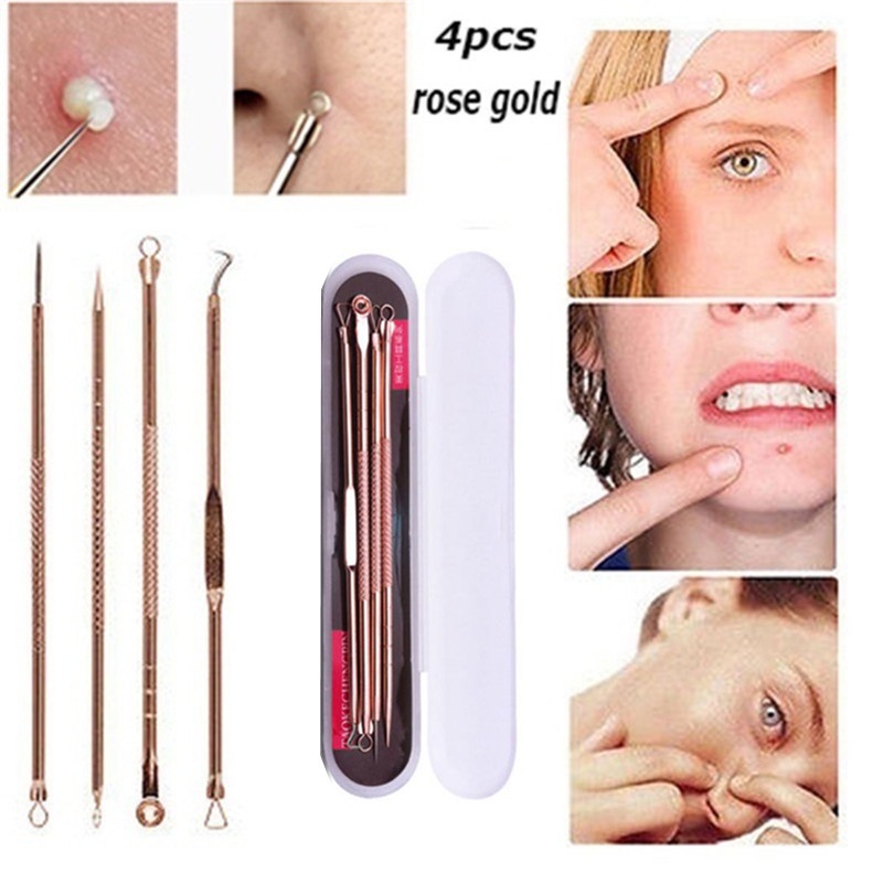 Set 4 Cây Nặn Mụn Đầu Đen Bằng Thép Không Gỉ Tiện Dụng