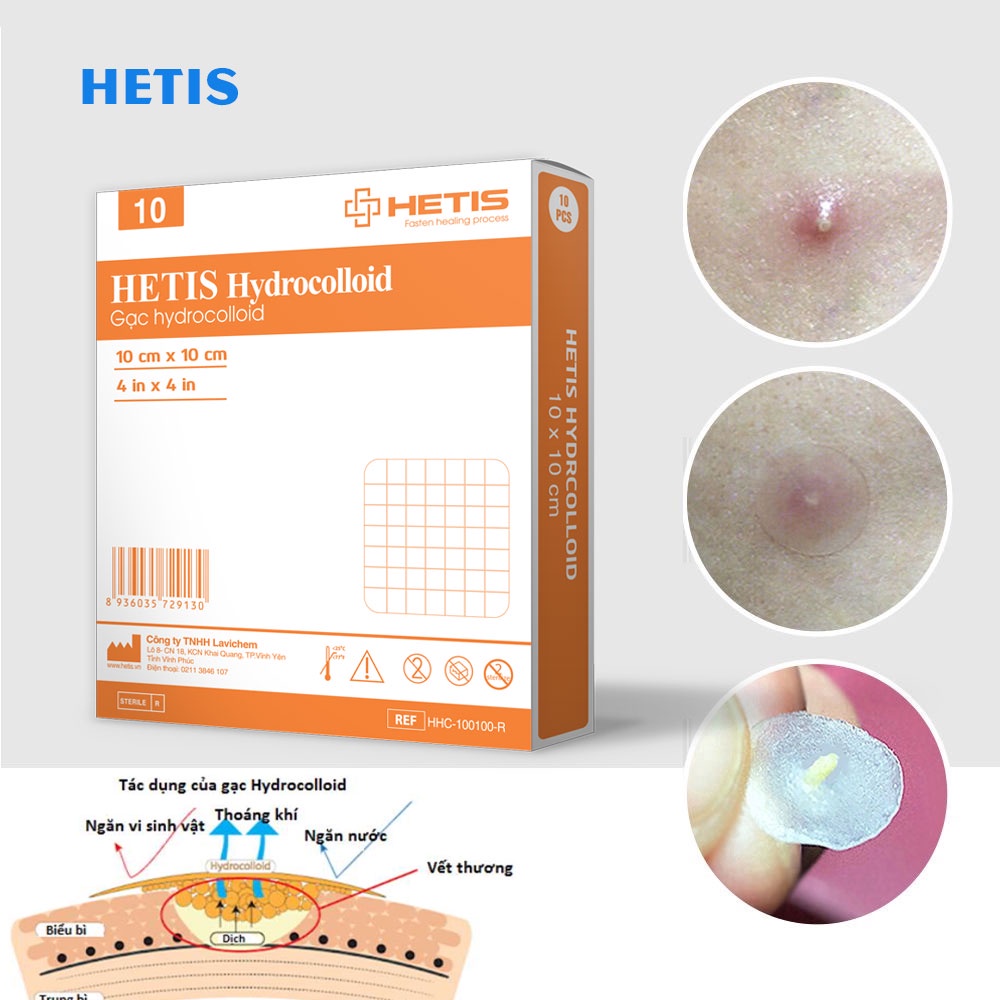 Mô tả Miếng Dán Mụn, Vết Thương ALFASEPT HETIS HYDROCOLLOID Giúp Thấm hút Dịch, Loại Bỏ Những Mô Chết, Ngăn Ngừa Sẹo - 4