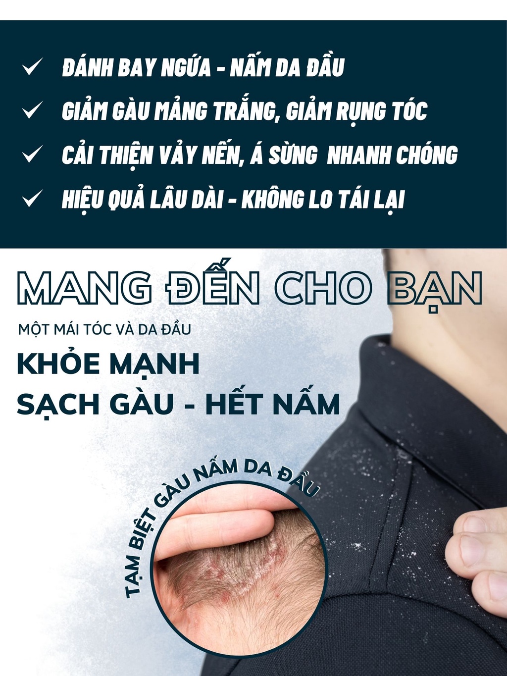 Mô tả Combo 3 Dầu Gội Sạch Nấm DEGO PHARMA 80ml - Dứt Điểm Gàu Ngứa & Nấm Da Đầu - Chiết Xuất Thiên Nhiên - 1