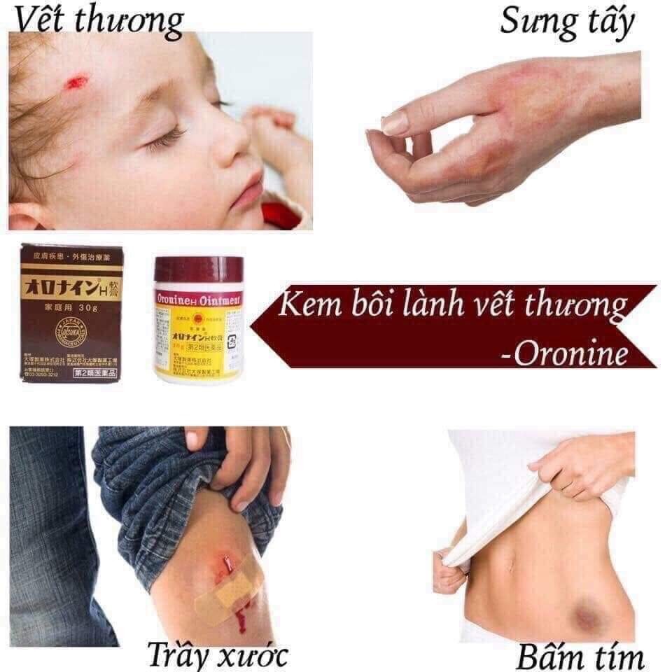 Thuốc mỡ Oronine có tác dụng hành huyết như thế nào?
