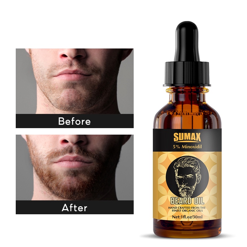 Ảnh Bộ tăng trưởng râu 30ml Con lăn râu Dầu tăng trưởng râu nam với con lăn râu Con lăn Microneedle 3