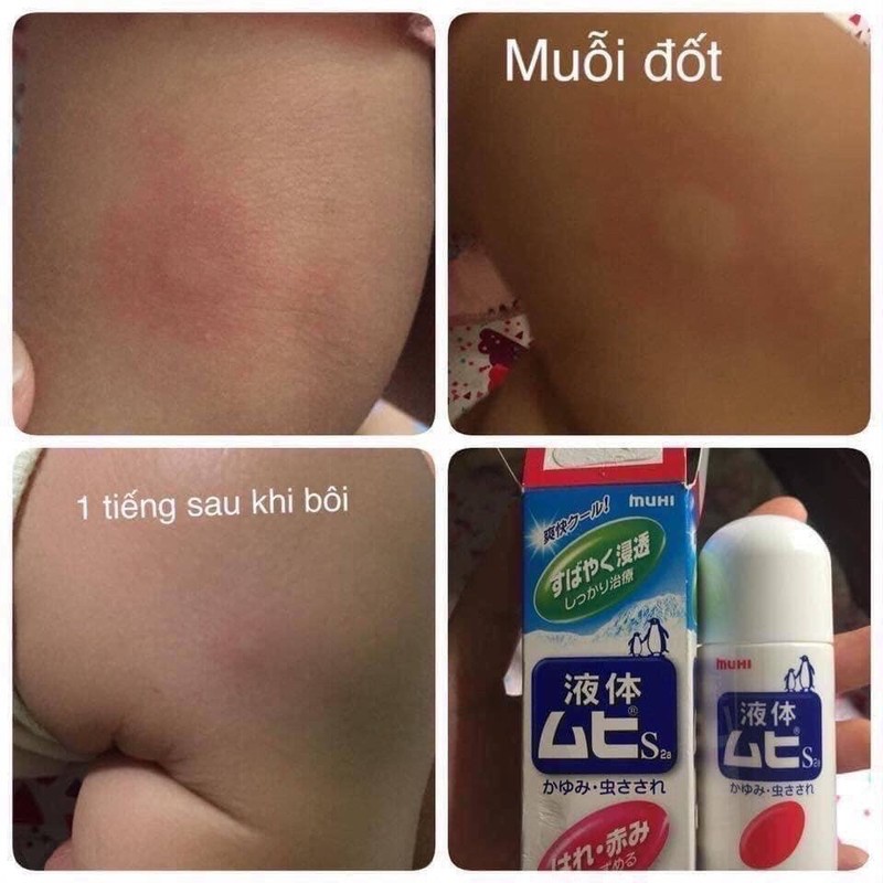 Bôi lăn muỗi côn trùng cắn, đốt Muhi 50ml [ Hàng Nội Địa Nhật ]