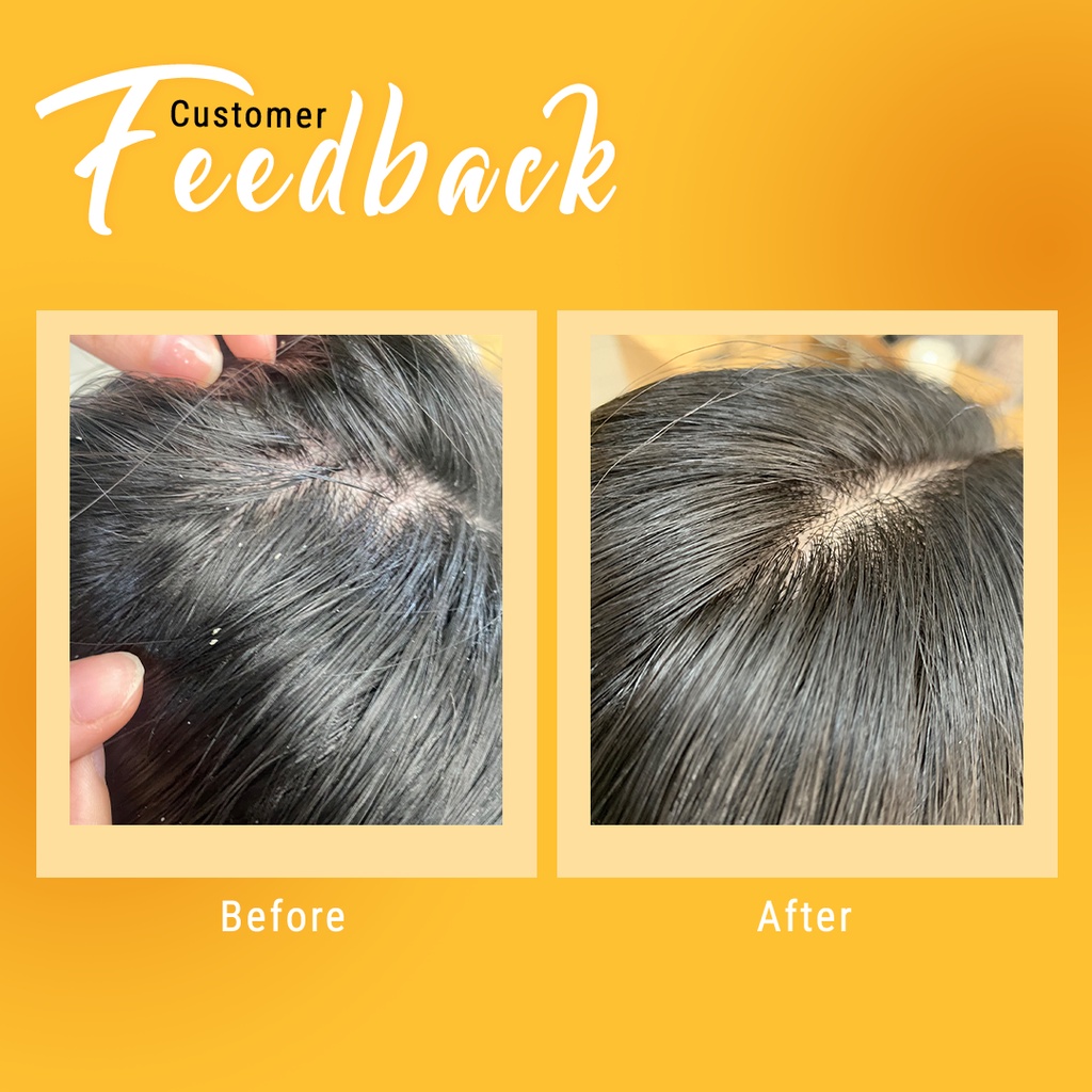 Ảnh Muối gội tẩy tế bào chết da đầu, tóc BareSoul FREE Hair Scrub 330g 2