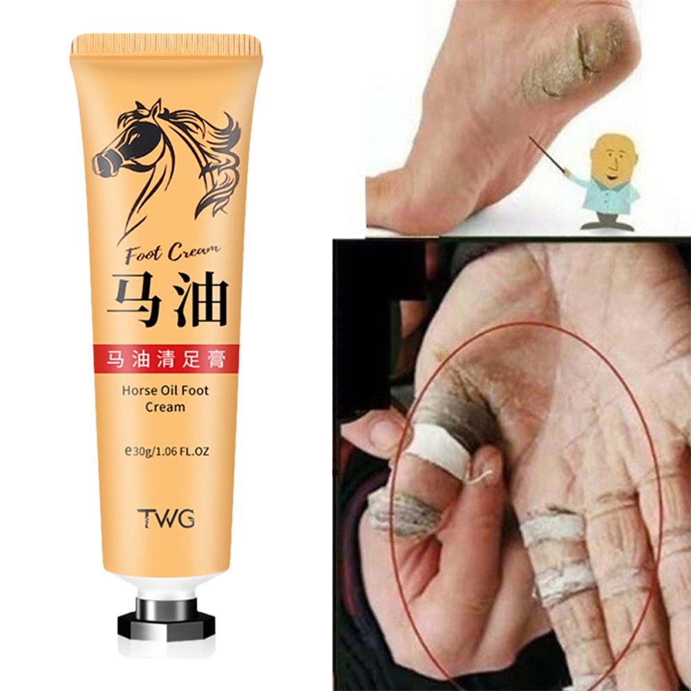 1 Tuýp Kem Dầu Ngựa Trị Nứt Gót Chân Chống Khô Da