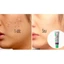 Kem Sẹo Gentacin Của Nhật Bản 10gr