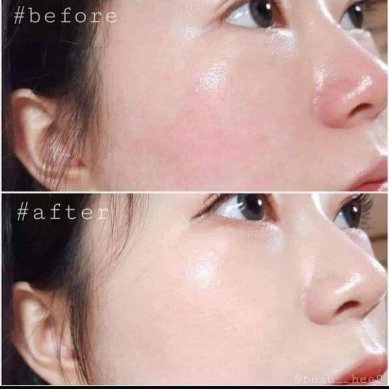 Serum Filler Aqua Kết Hợp Peptide Oz Witch Recipe 100ml Chính Hãng - Căng Bóng Thu Nhỏ Lỗ Chân