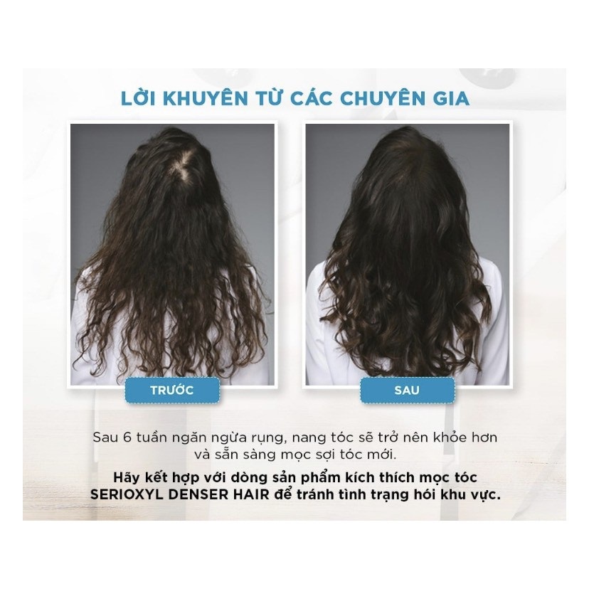 Tinh chất giảm rụng tóc L'Oréal Pro Aminexil Advanced New 2023 (10 lọ x 6ml) + Lược nâu massage