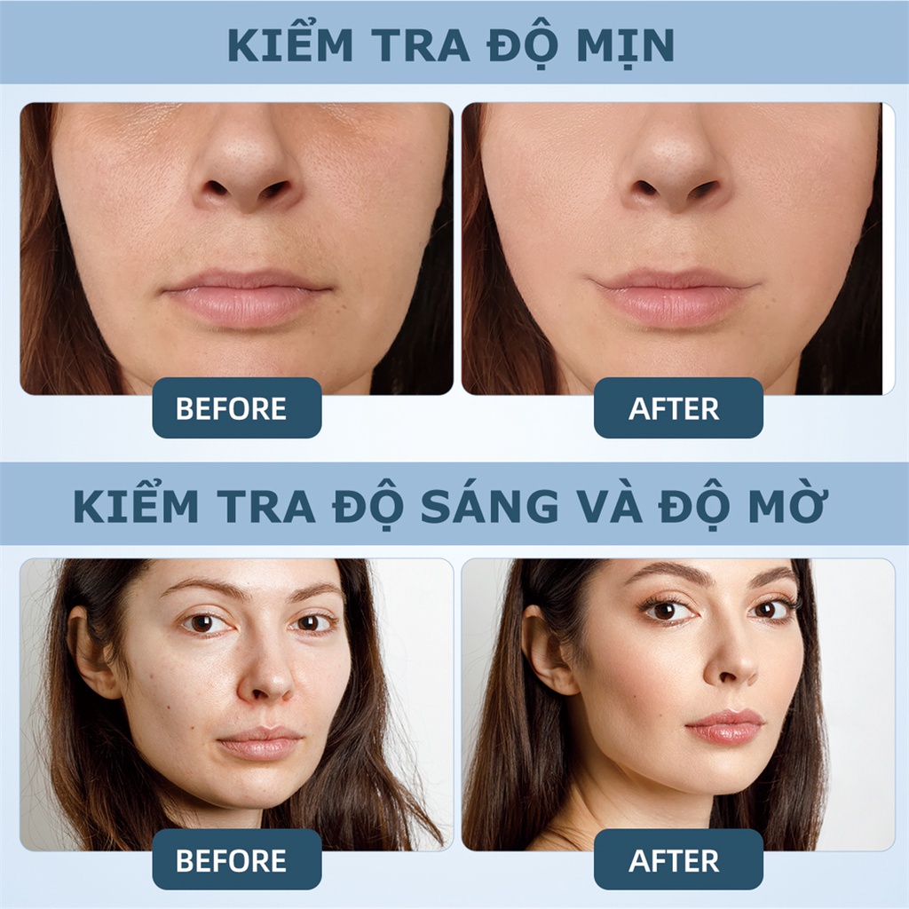 Mô tả Gel lạnh CKEYIN 40ml cho máy nâng cơ/ Hifu/ máy tẩy lông/ RF MR663 - 6