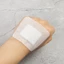 ITRUMPET 5 / 10 Chiếc Dây Đeo Vết Thương, Băng Hỗ Trợ Tự Dính Thoáng Khí Không Dệt, Nhiều Kích Thước Trong Suốt 6x7cm 6x10cm Băng Vết Thương Lớn Băng Tự Dính