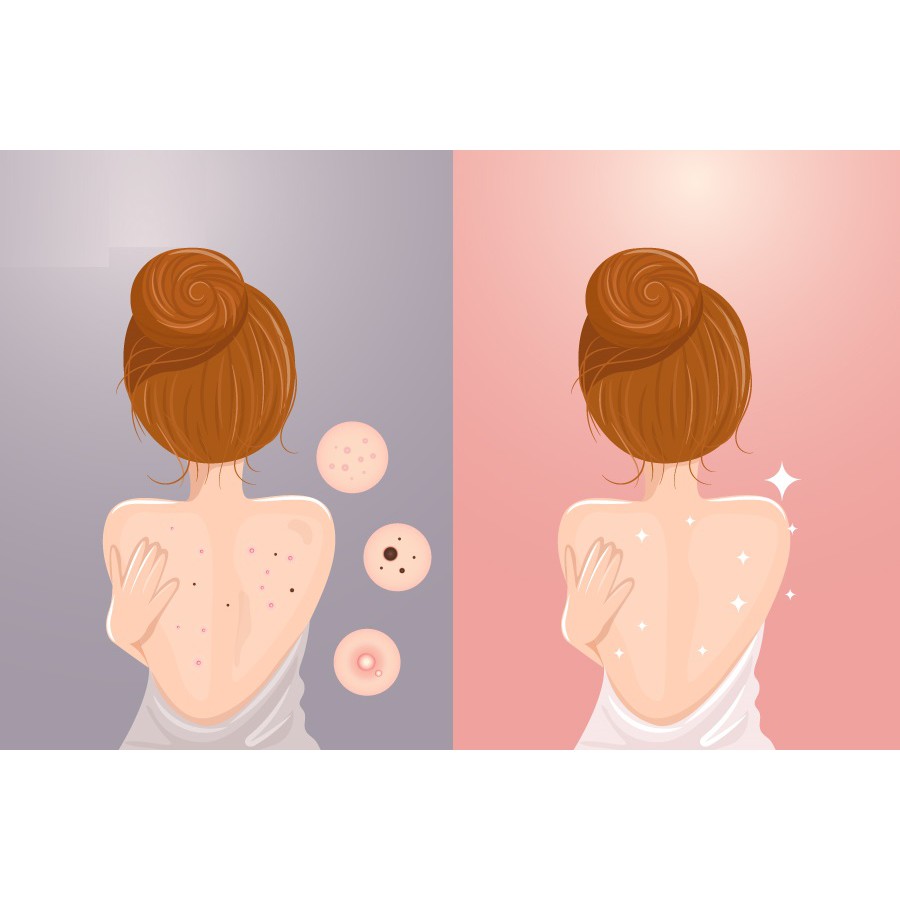 Ảnh [Tặng túi tạo bọt] Xà Phòng Giảm Mụn Cơ Thể Sau 7 Ngày Derladie Body Cleansing Bar For Blemish Skin 50g 4
