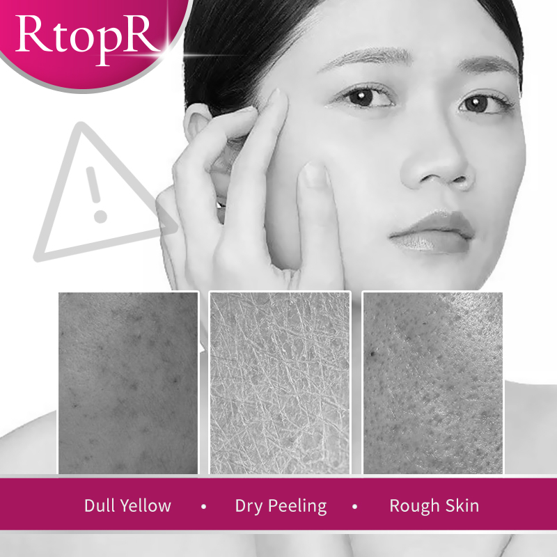Ảnh Kem dưỡng da mặt RTOPR chiết xuất xoài chống nếp nhăn chống lão hóa giữ ẩm se khít lỗ chân lông dưỡng ẩm và kiềm dầu 30g 2