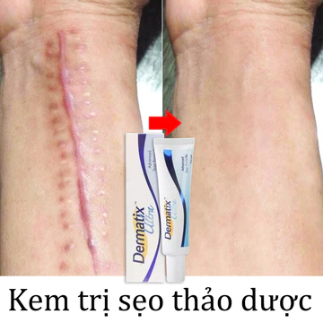 ⭐CHÍNH HÃNG⭐ Gel Kem Làm Mờ Sẹo Thâm, Sẹo Lồi ,trị sẹo15g Xóa vết rạn da Sửa chữa vết sẹo mạnh mẽ Vết sẹo bỏng
