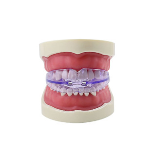 Thiết bị nha khoa răng căn chỉnh răng aligner trainer niềng răng giữ