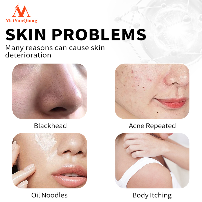 Ảnh MeiYanQiong Xà bông rửa mặt  than tre đen loại bỏ mụn đầu đen kiềm dầu se khít lỗ chân lông lớn hiệu quả 3