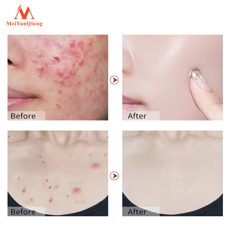 Ảnh MeiYanQiong Xà bông rửa mặt  than tre đen loại bỏ mụn đầu đen kiềm dầu se khít lỗ chân lông lớn hiệu quả 4