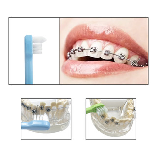 Bàn Chải Đánh Răng Chỉnh Hình Đầu Nhỏ Gọn Nhỏ Gọn Bằng Thiếc Làm Sạch Răng Và Chi Tiết Răng
