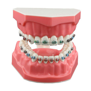 Mô Hình Hỗ Trợ Học Tập Chỉnh Hình Bằng Dây Kim Loại Và Giá Đỡ Tiện Dụng Cho Người Lớn Và Trẻ Em