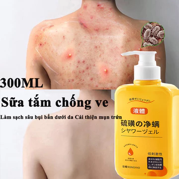 ⭐CHÍNH HÃNG⭐ Sữa tắm chống ve Sữa tắm loại bỏ mụn 300ml Làm sạch sâu bụi bẩn dưới da Cải thiện mụn trứn.sữa tắm trắng da