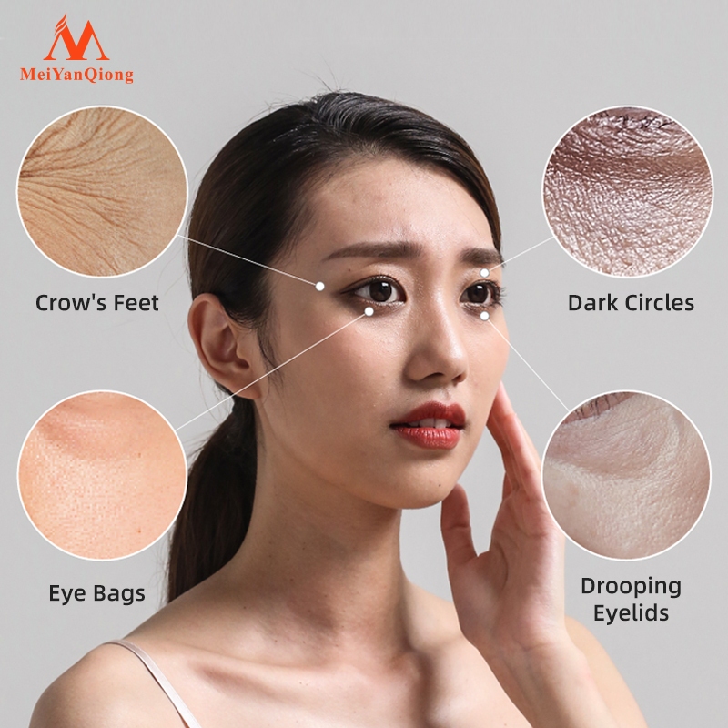 Ảnh MeiYanQiong Tái TạoTinh Chất Dưỡng Da Vùng Mắt Chống Lão Hóa Loại Bỏ Nếp Nhăn Rejuvenating eye Serum12ml 2