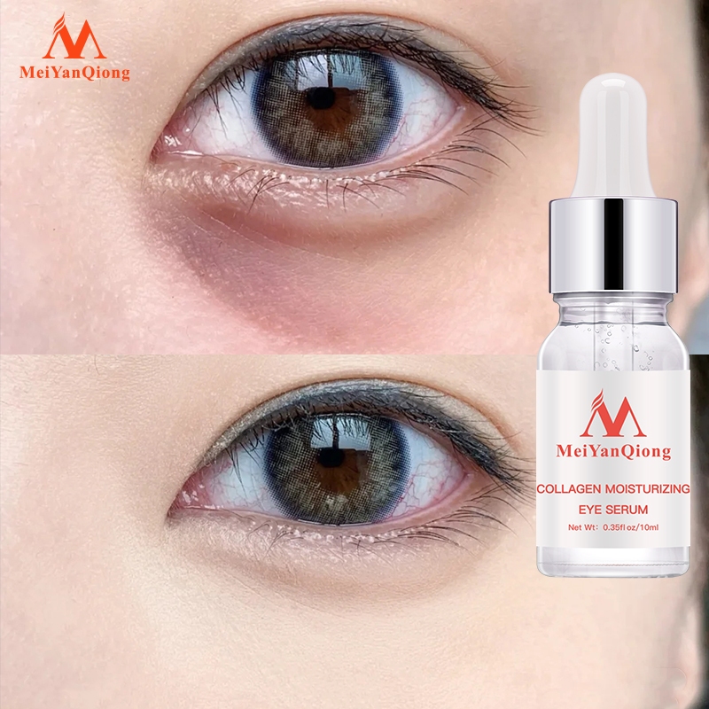 Ảnh MeiYanQiong Tái TạoTinh Chất Dưỡng Da Vùng Mắt Chống Lão Hóa Loại Bỏ Nếp Nhăn Rejuvenating eye Serum12ml 4