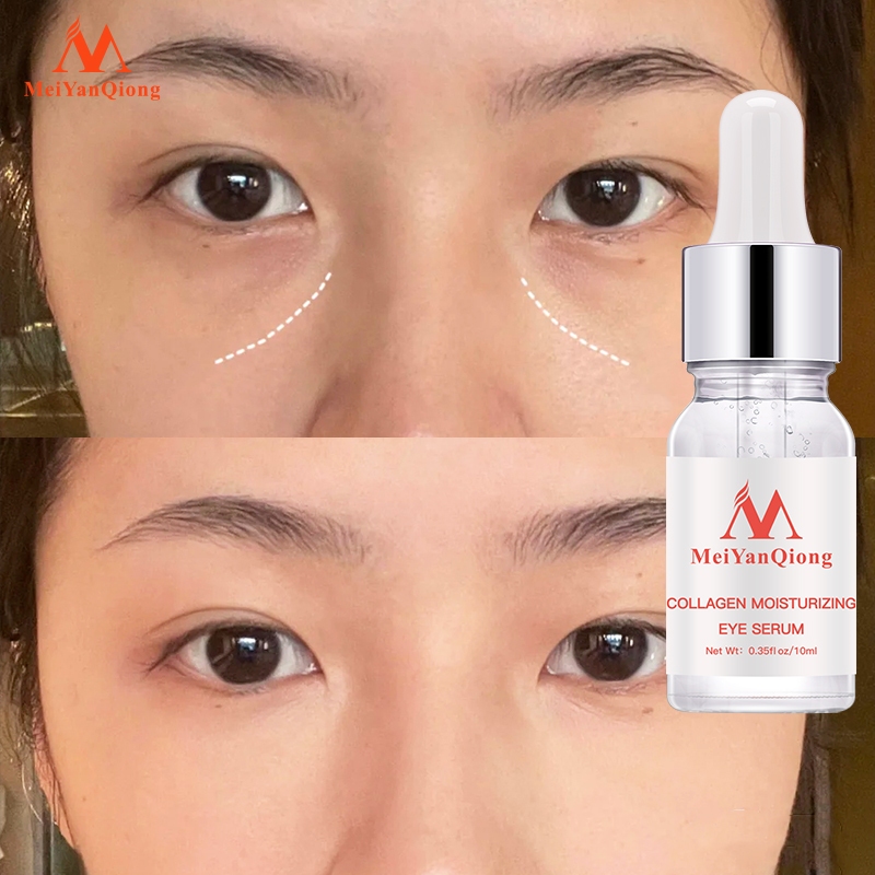Ảnh MeiYanQiong Tái TạoTinh Chất Dưỡng Da Vùng Mắt Chống Lão Hóa Loại Bỏ Nếp Nhăn Rejuvenating eye Serum12ml 3
