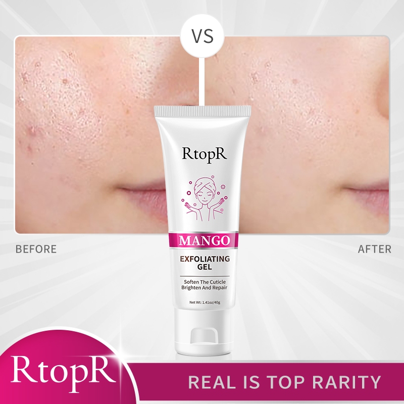 Ảnh Rtopr Bộ Kem Dưỡng Da Cổ + gel Tẩy Tế Bào Chết + Răng Bạc Hà Làm Trắng Da 2