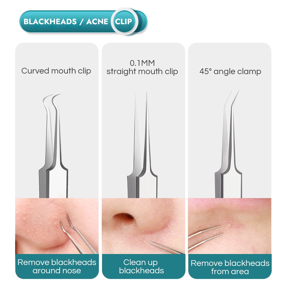 Gecomo Bộ Dụng Cụ Nặn Mụn Đầu Đen Bằng Thép Không Gỉ Độ Chính Xác Cao