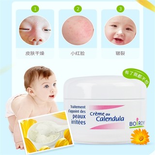 Pháp boiron Calendula Eczema Cream cho bé Kem dưỡng da mặt đỏ, dưỡng ẩm cho trẻ mới biết đi, chăm sóc da