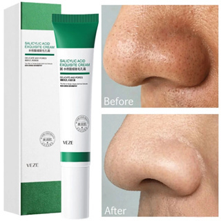 Kem Axit Salicylic 20ml Se Khít Lỗ Chân Lông Cải Thiện Mụn Đầu Đen Làm Trắng Kiềm Dầu Chống Lão Hóa