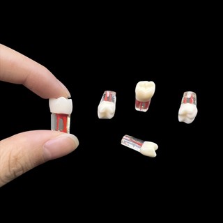 Mô hình răng nha khoa Mô hình đào tạo kênh gốc Mô phỏng Nha khoa RCT Thực hành Bột giấy Khoang Nội nha Giảng dạy Mô hình nghiên cứu