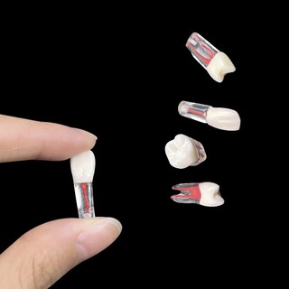 Mô hình răng nha khoa Mô hình đào tạo kênh gốc Mô phỏng Nha khoa RCT Thực hành Bột giấy Khoang Nội nha Giảng dạy Mô hình nghiên cứu
