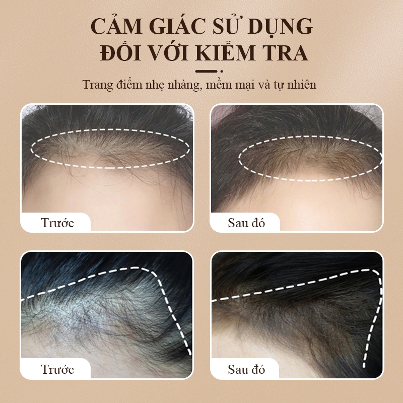 Phấn Che Khuyết Điểm Chân Tóc Sevich Chống Thấm Nước