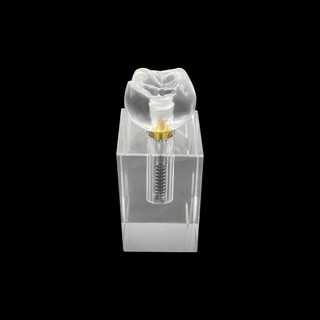 3x Mô hình cấy ghép nha khoa trong suốt Crystal Crown Phân tích có thể tháo rời Mô hình nghiên cứu Giảng dạy Mô hình nghiên cứu Dụng cụ nha khoa