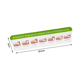 1 Cái Bệnh Nha Khoa Bột Rễ Điều Trị Kênh Phân Giải Biểu Đồ Lưu Lượng Thích Hợp Cho Nha Sĩ Truyền Thông Giảng Dạy Và Đào Tạo