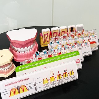 1 Cái Bệnh Nha Khoa Bột Rễ Điều Trị Kênh Phân Giải Biểu Đồ Lưu Lượng Thích Hợp Cho Nha Sĩ Truyền Thông Giảng Dạy Và Đào Tạo