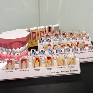 1 Cái Bệnh Nha Khoa Bột Rễ Điều Trị Kênh Phân Giải Biểu Đồ Lưu Lượng Thích Hợp Cho Nha Sĩ Truyền Thông Giảng Dạy Và Đào Tạo