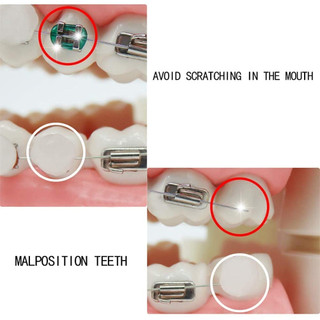 Sáp Cho Niềng Răng 50 Gói Sáp Nha Khoa Nẹp Wearer Sáp Để Giảm Kích Ứng Và Đau