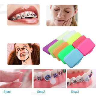 Sáp Cho Niềng Răng 50 Gói Sáp Nha Khoa Nẹp Wearer Sáp Để Giảm Kích Ứng Và Đau