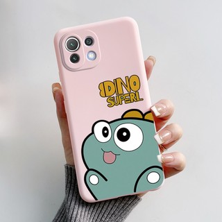 Ốp lưng Xiaomi Mi 11 Lite 4G 5G NE Vỏ silicon mềm mờ thiết kế mới Vỏ hoạt hình cho vỏ Xiaomi Mi11 Lite