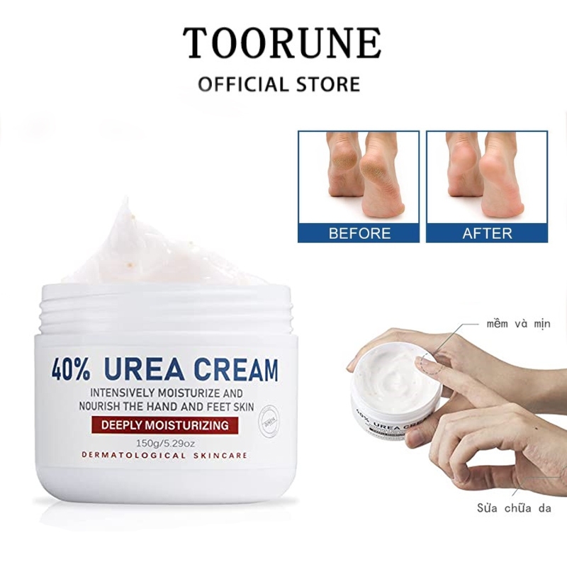 Minijumie OUKEYA Kem nẻ gót chân Oukeya Foot Cream giảm nẻ chân nứt chân khô da dưỡng gót 150g