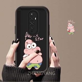 Ốp Lưng Cho OPPO Reno 2F Reno 2 Reno Silicone TPU Ốp Điện Thoại Họa Tiết Hoạt Hình Dễ Thương Chống Rơi Và Chống Sốc Vỏ Mềm Điện Thoại Có Thể Che camera