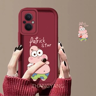 Ốp Lưng Cho OPPO Reno 7Z 5G Reno 8Z 5G Ốp Điện Thoại TPU Silicon Họa Tiết Hoạt Hình Dễ Thương Chống Rơi Và Chống Sốc Vỏ Mềm Có Thể Che camera