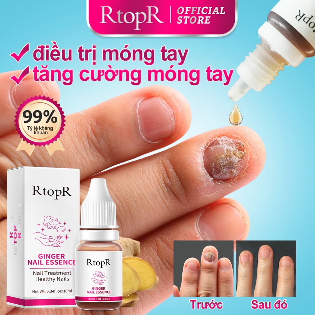Ảnh Tinh chất gừng RTOPR kháng khuẩn hỗ trợ giảm bệnh nấm móng chân 10ml 1