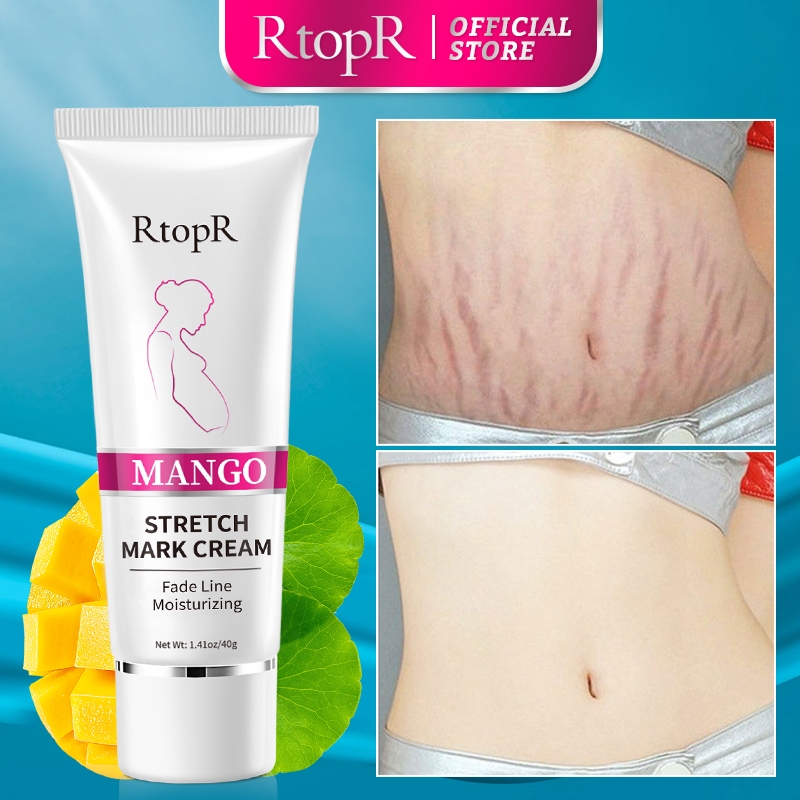 Ảnh RtopR Xoài Xóa Sẹo Mang Thai Kem Rạn Da Kem Làm Săn Chắc Cơ Thể 40g RtopR Mango Remove Pregnancy Stretch Marks Maternity Cream 1