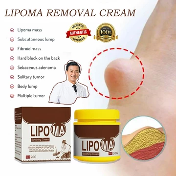 Kem tan u mỡ Kem bôi u bướu mỡ loại bỏ lipoma tinh chất thảo dược thiên nhiên Kem lipoma Loại bỏ mỡ dưới da teasovn
