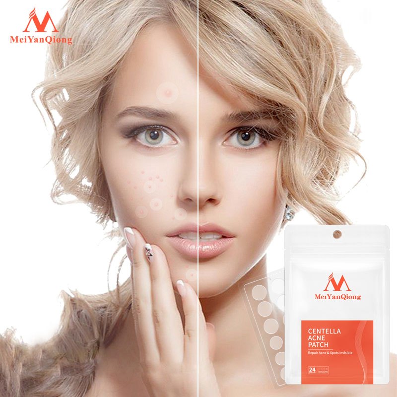 Ảnh Meiyanqiong Miếng dán lột mụn đầu đen Sửa chữa và làm sạch sâu da mặt 24 viên 3
