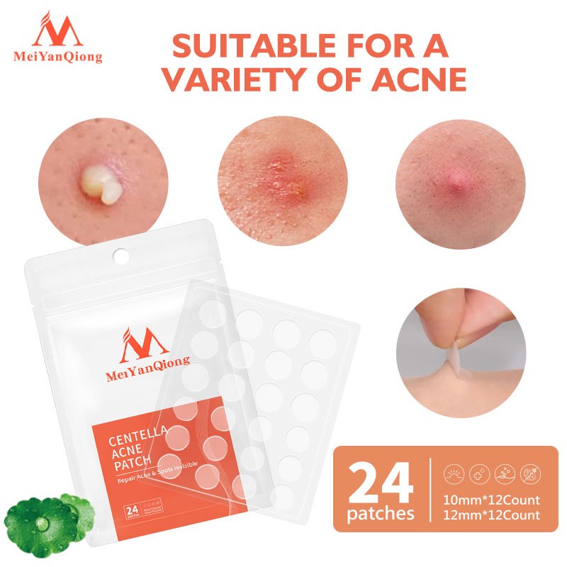 Ảnh Meiyanqiong Miếng dán lột mụn đầu đen Sửa chữa và làm sạch sâu da mặt 24 viên 2