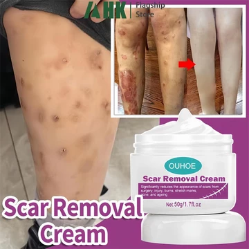 Kem tẩy sẹo hiệu quả 50g Loại bỏ sẹo tự nhiên cho vết sẹo cũ Vết rạn da Peklat Tẩy sẹo Kem sửa chữa