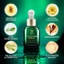 BSKM Serum hỗ trợ giảm mụn dưỡng ẩm làm mịn da xóa mờ vết thâm hiệu quả chuyên dụng 28g 0185